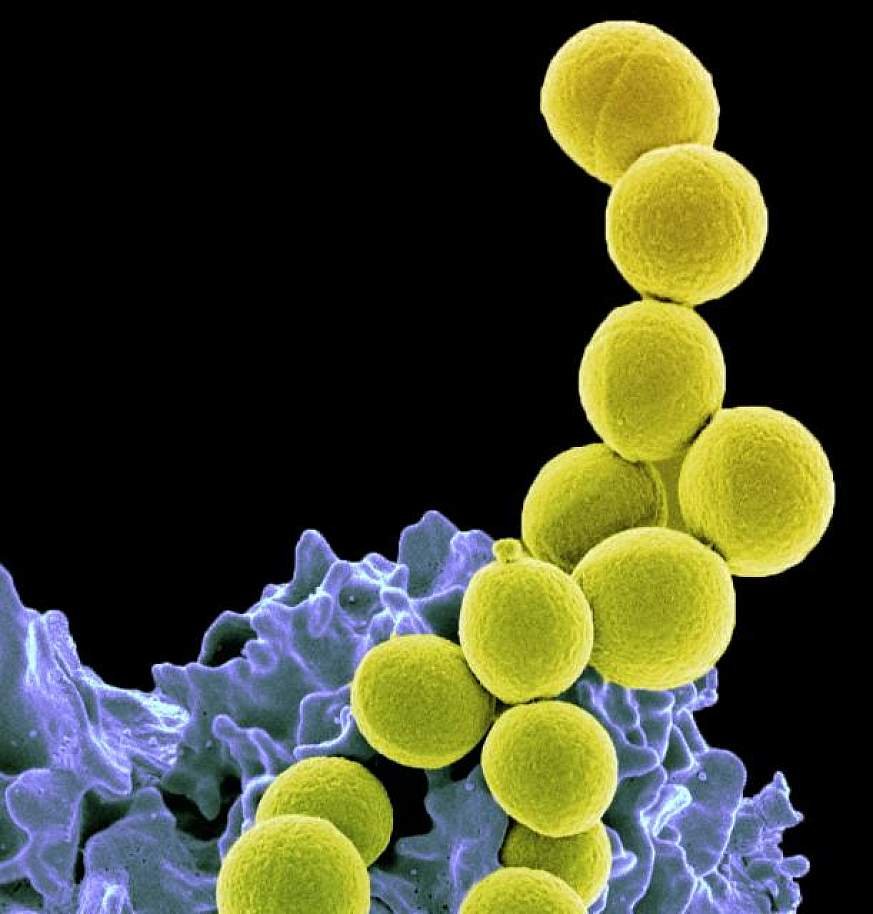Probiotic markedly reduces S. aureus colonization in Phase 2 trial | National Institutes of Health (NIH)
